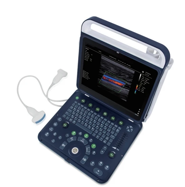 Ultra sound machine portable ultrasonic scan knee injury sonography machine prices gray scale supply hospital equipments