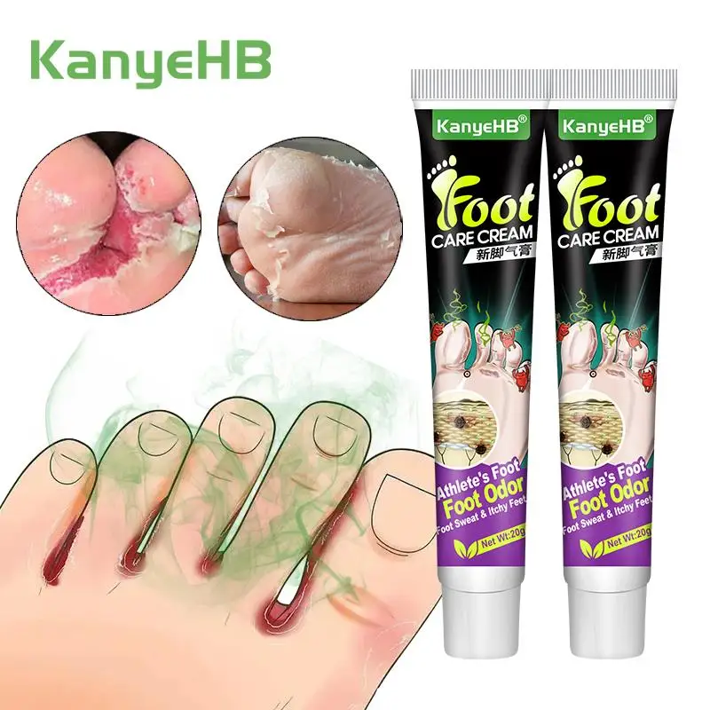 

2pcs Athlete's Foot Beriberi Anti-itch Cream Treatment Feet Odor And Peeling Anti Fungal Infections Foot Care Ointment A1283