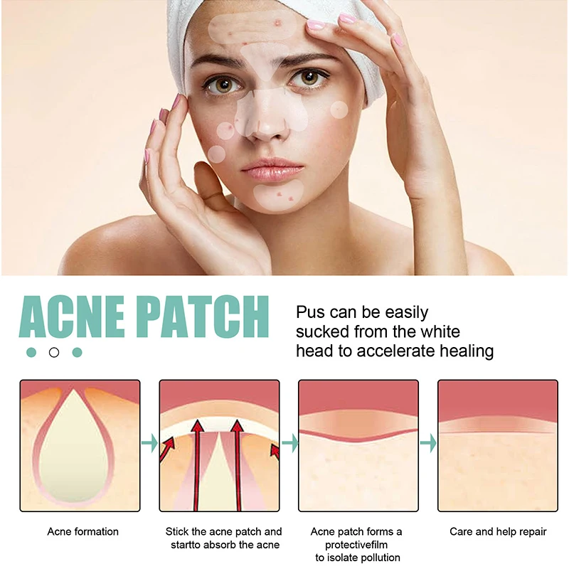 132 Stuks Acne Spot Behandeling Patch Huidverzorging, Vlek Spot Gezichtsmasker, Hydrocolloïde Mee-Eter Remover, Acne Puistje Patches Sticker