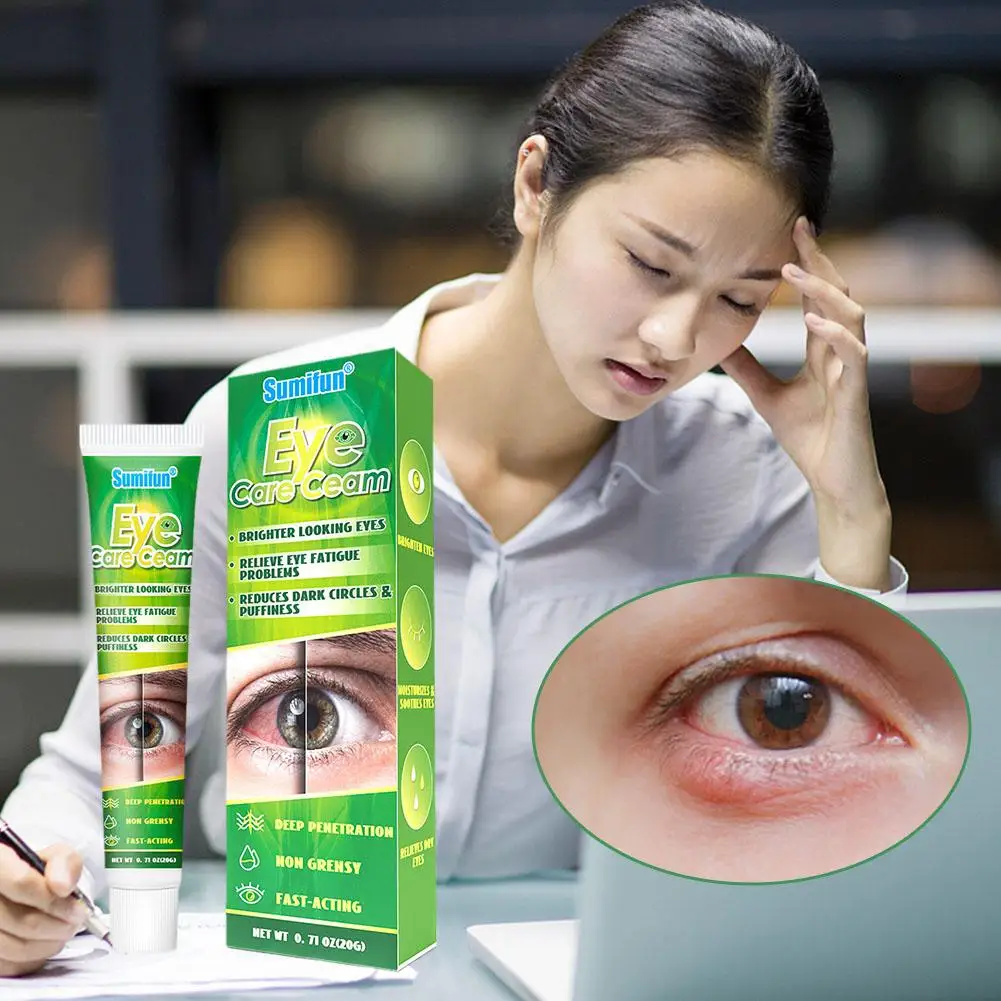 Crema china de medicina Herbal para el cuidado de los ojos, Ojos de aspecto más brillante, alivia los problemas de fatiga ocular, reduce las ojeras y la hinchazón