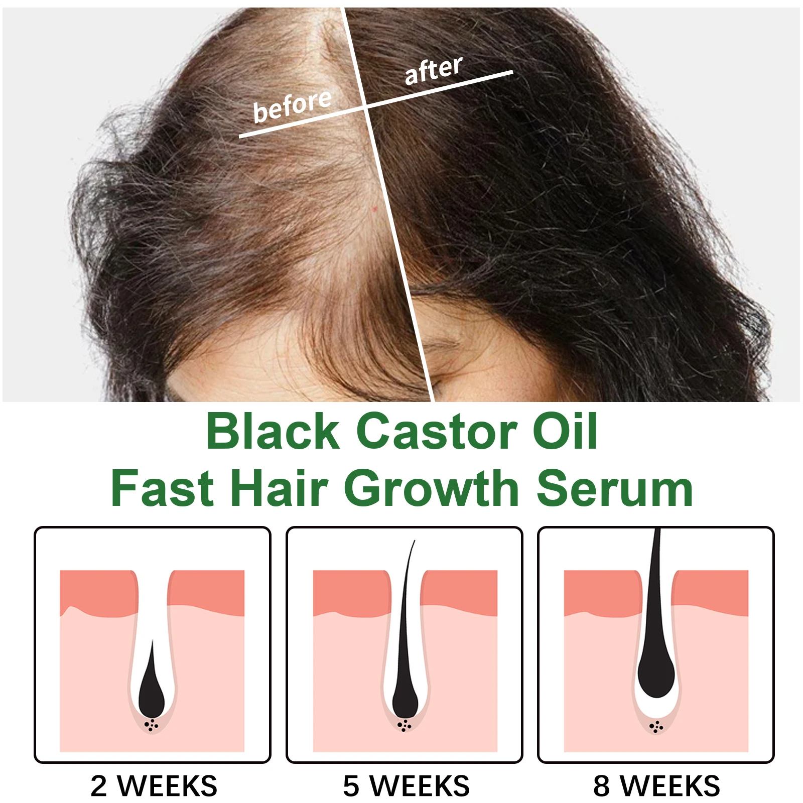 Jaysuing Hair Serum Support Repair Damaged Hair Prevent Hair From Falling Out For  Hair Growth with Natural Herbal Hair Care Oil