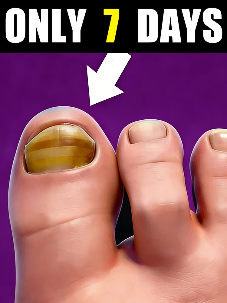 

Поломте от хрупких желтых ногтей, кончики пальцев превращают яркий