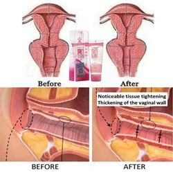 20ml Tightening Gel Vaginal Shrink Cream Tighter for Women Couple Sexy Aid Be Always Again Cream Make Him Feel Bigger Orgasm