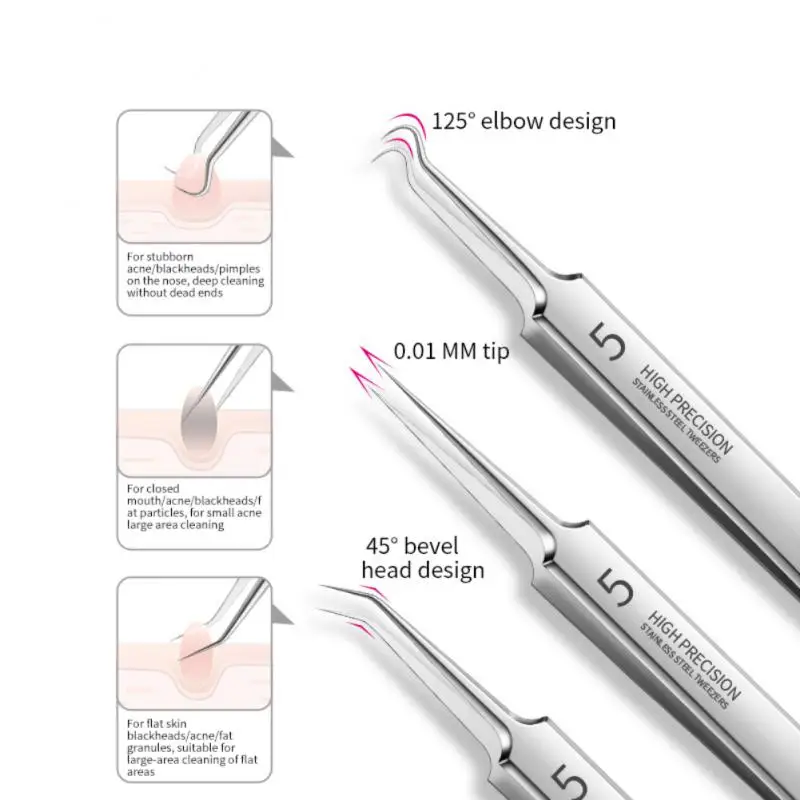 Mee-eter en bestand tegen uitglijden 5-specificaties Acne-mee-eternaaldpincet Voelt comfortabel aan Acne-clip van roestvrij staal