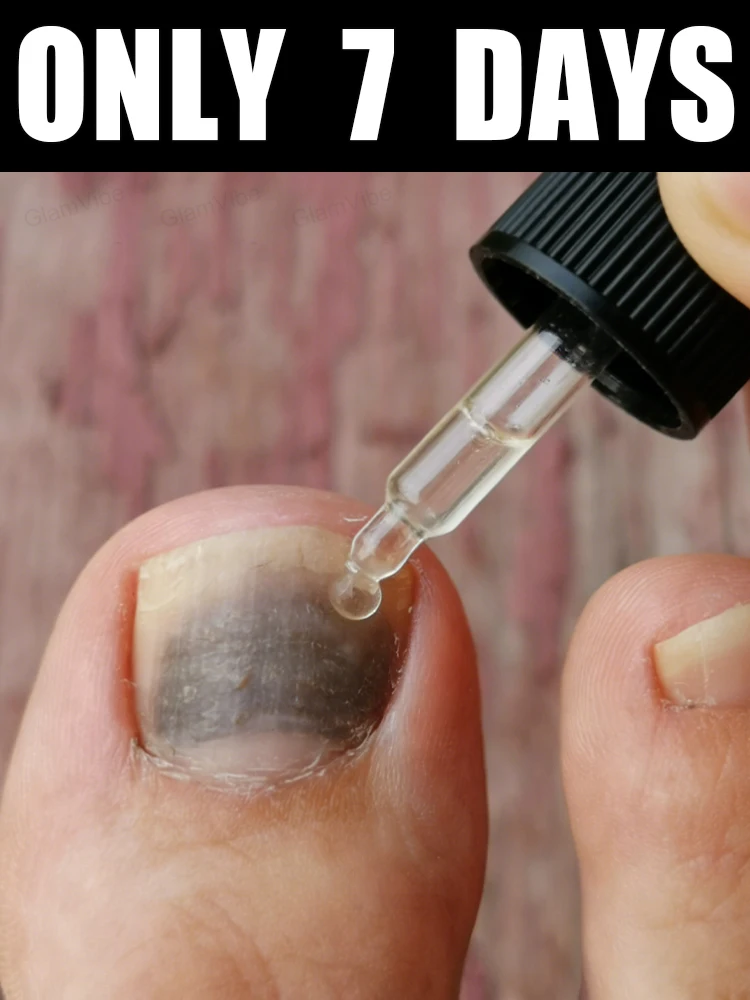 

Great news! Free shipping in 2026! Nail care solution, 10ml