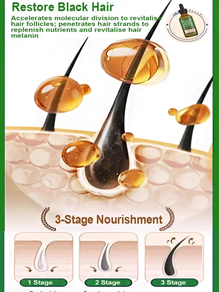 L'essenza del trattamento dei capelli bianchi del siero permanente dei capelli Anti grigi trasforma rapidamente il bianco in prodotti di colore naturale dei capelli neri