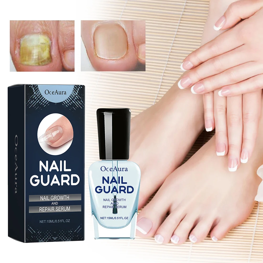 15Ml Nagelreparerende Vloeibare Nagelversterker Voedende Crème Zacht Glanzend Nagelreparatieserum Voor Thuisvingerteen Nagelverzorging