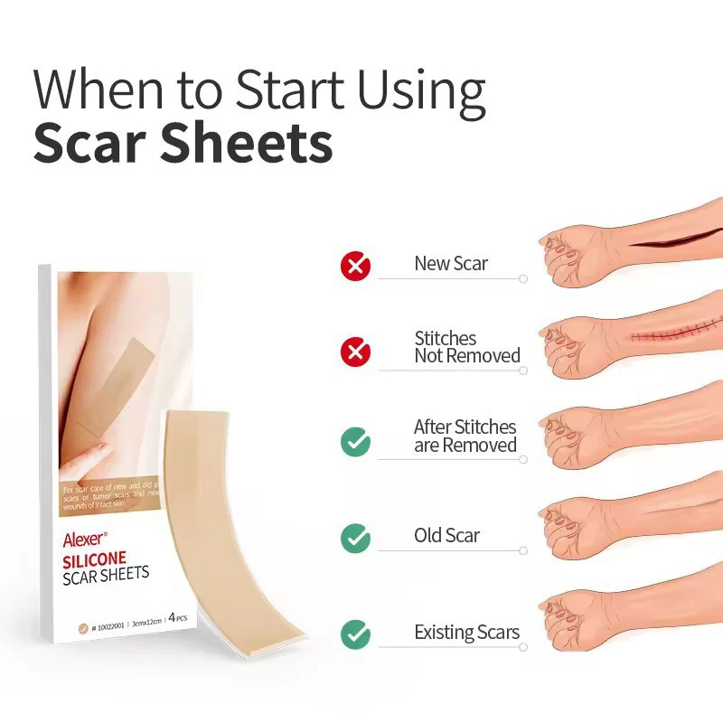 Silicone Scar Tape For Surgical Scars Medical Grade Silicone Scar Sheet Painless Effective Scar Repair Tape