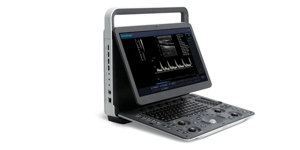 SonoScape B/W Ultrasound Portable Ultrasound Machine Portable Ultrasound Scanner E1 With Linear Probe