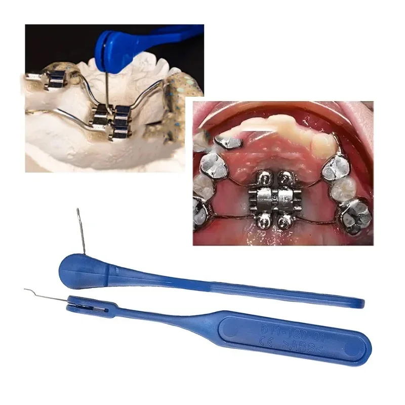 2pc Dental Expansion Screw Ortho Expander Swivel Keys Rapid Palatal For Frame Material Tool Oral Orthodontic Instrument Supplies