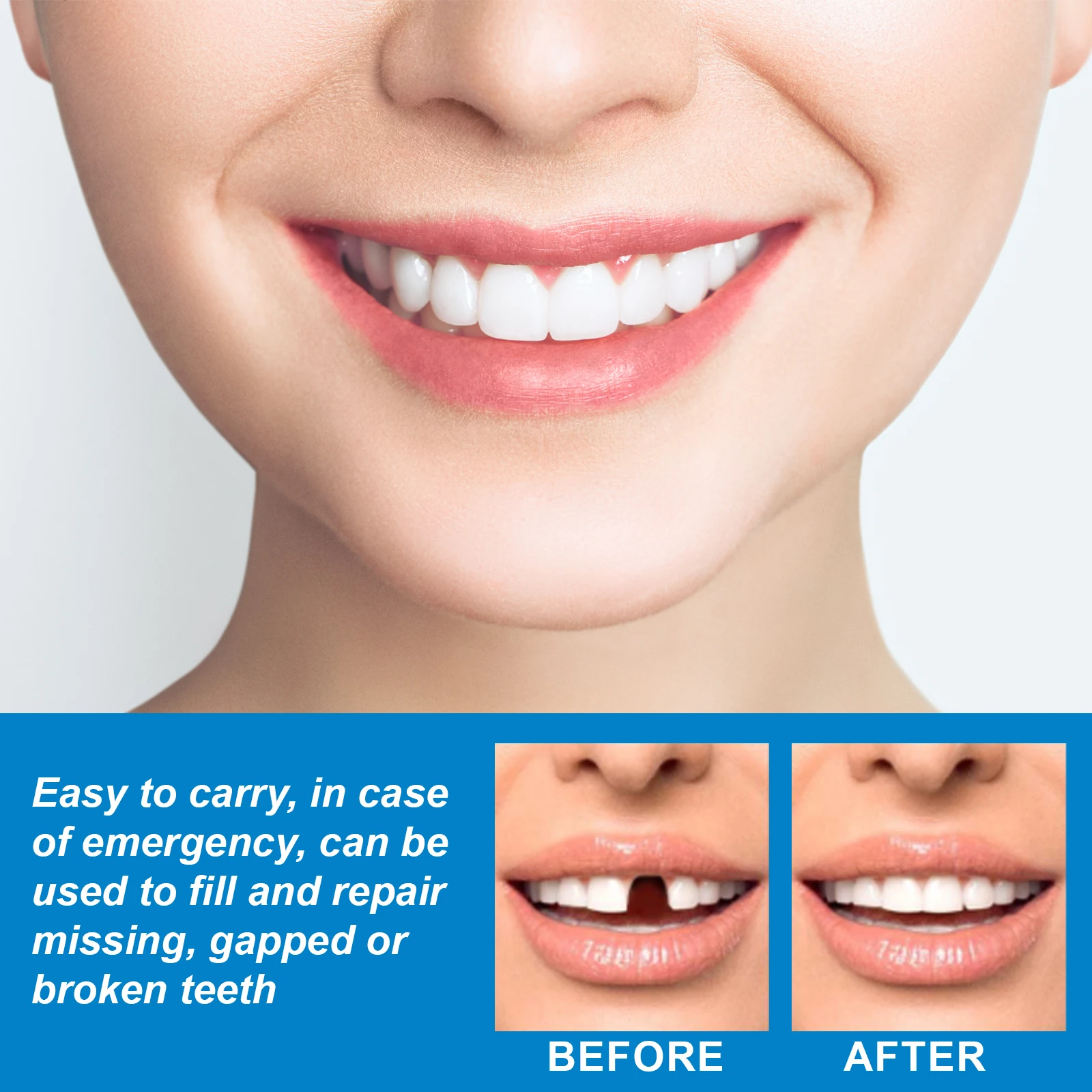 Thumbnail 3 - #2 Cheapest Denture Adhesives Deals You Can Get