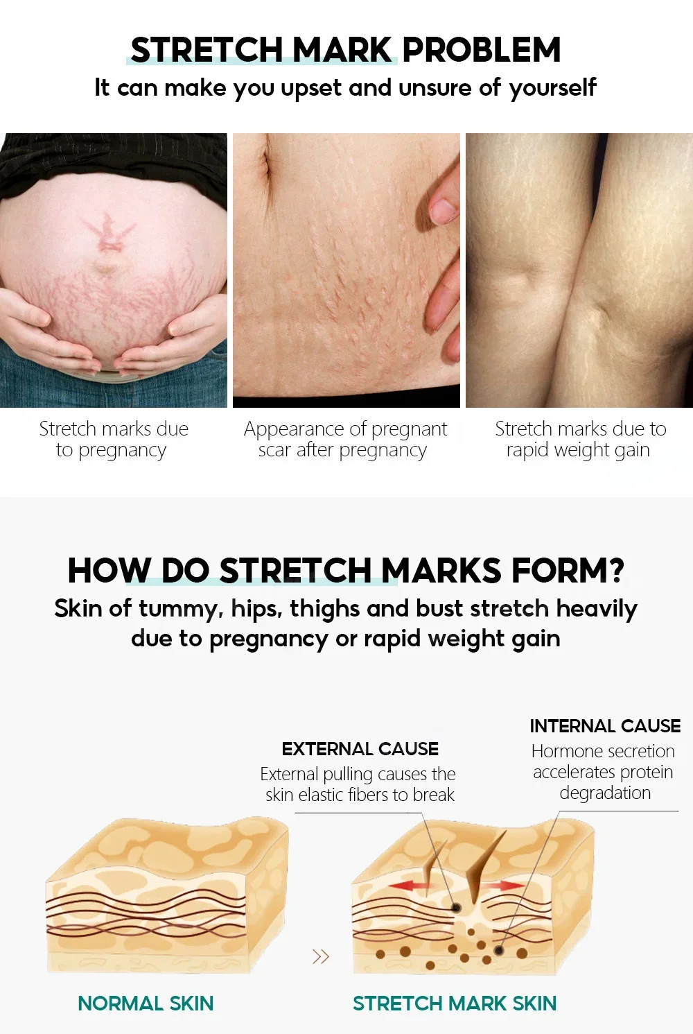 

Firming Body Moisturizer Improve Skin Sagging Tighten Arms Thighs Belly Stretch Marks Removal Cream Fade Fine Lines Body Lotion