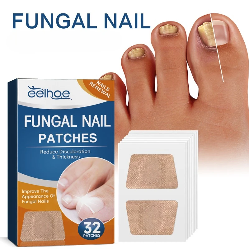 Fungal Nail Treatment Patch Anti Infection Paronychia Thickening Soft Onychomycosis Repair Ingrown Toenails Correction Stickers