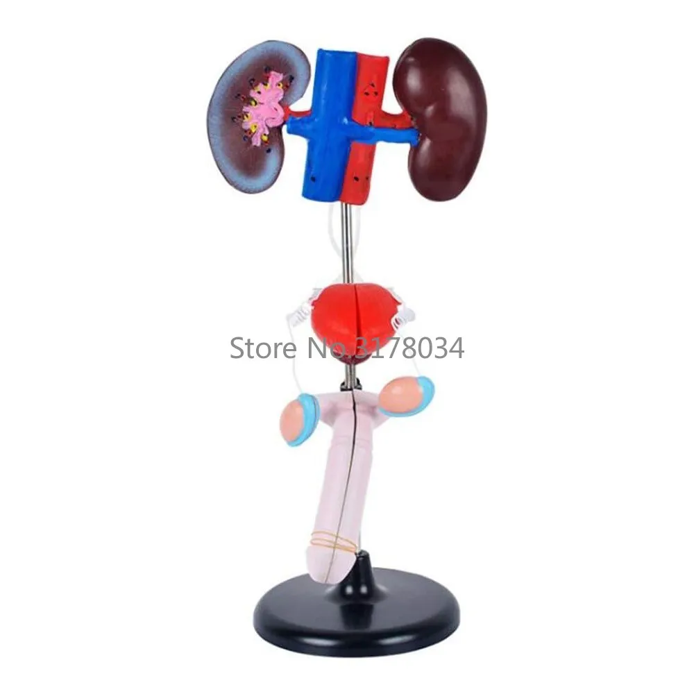 Human Genitourinary System Model Organ Anatomy Model Male Genitourinary Model for Medical Educational Training Aid