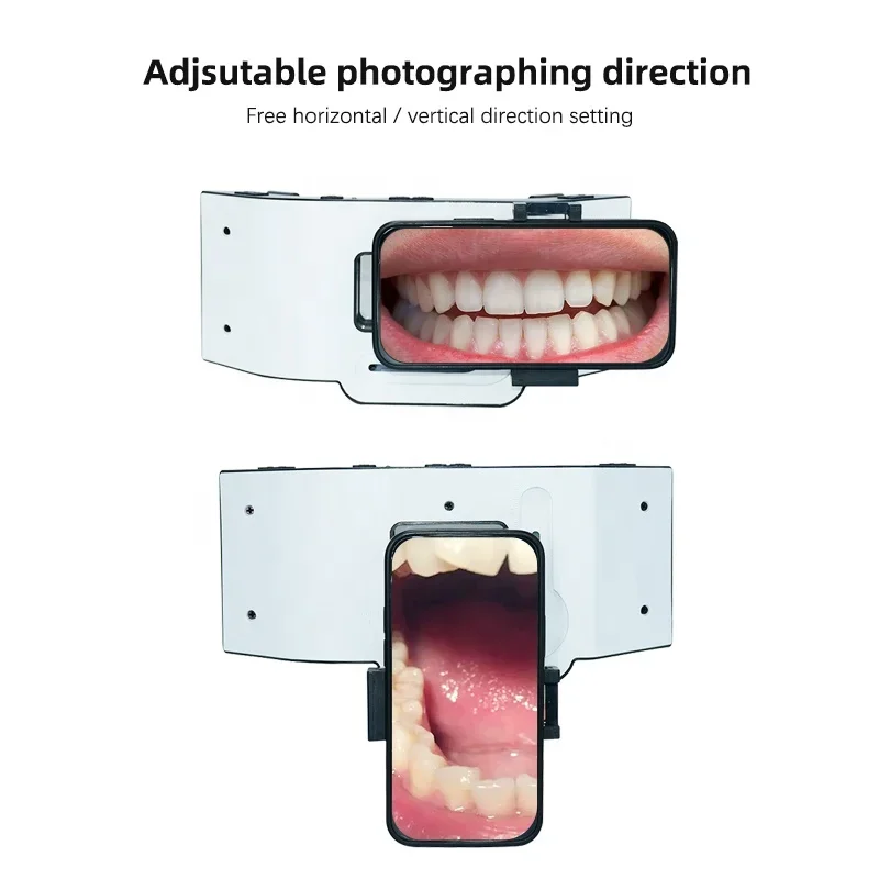 Orthodontics Equipment Light Mobile den tal Flash Light Photography Oral Filling Lamp