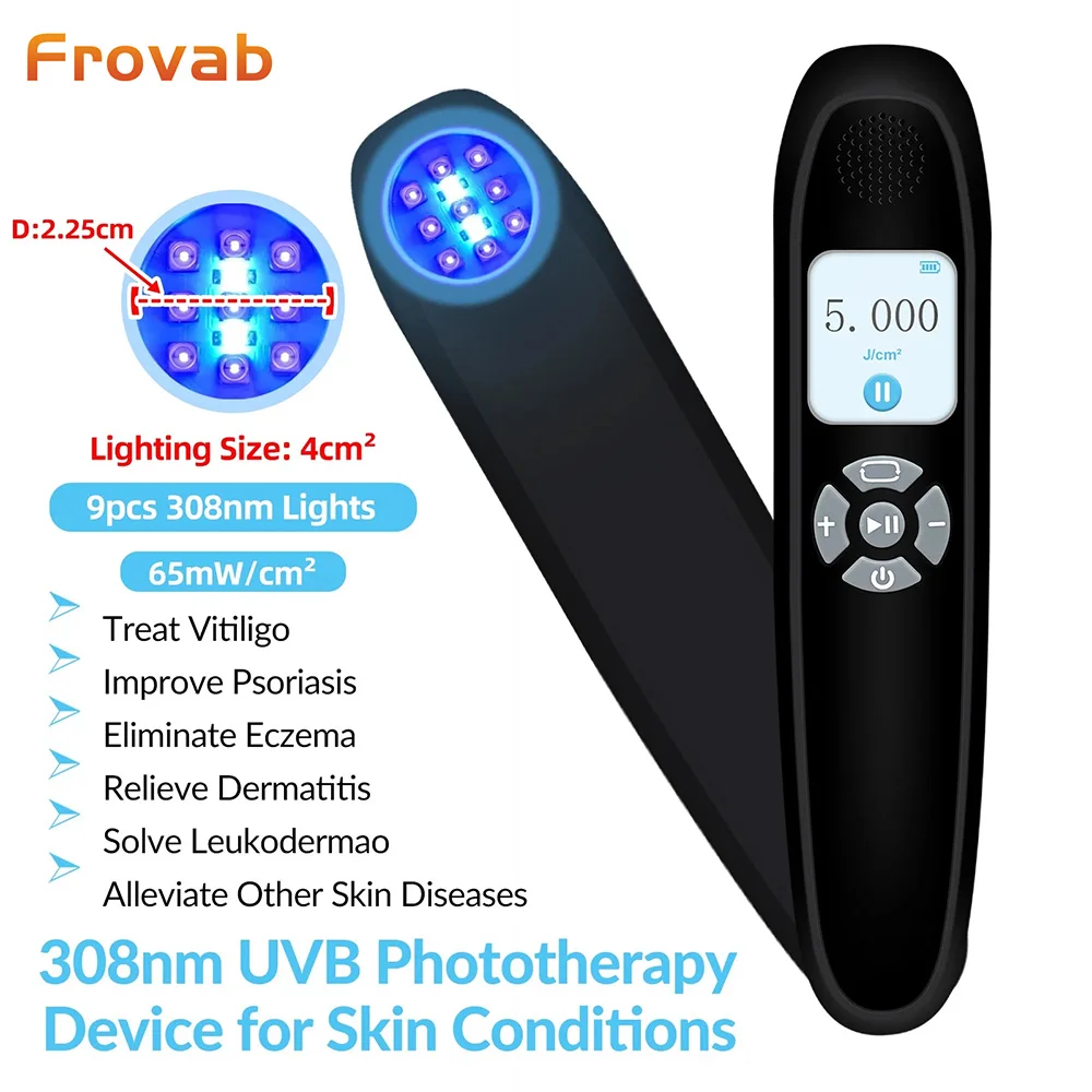 Frovab 308nm UVB Excimer Laser Phototherapy Lamp Medical Grade Skin Disorder Treatment Vitiligo Psoriasis Eczema Device