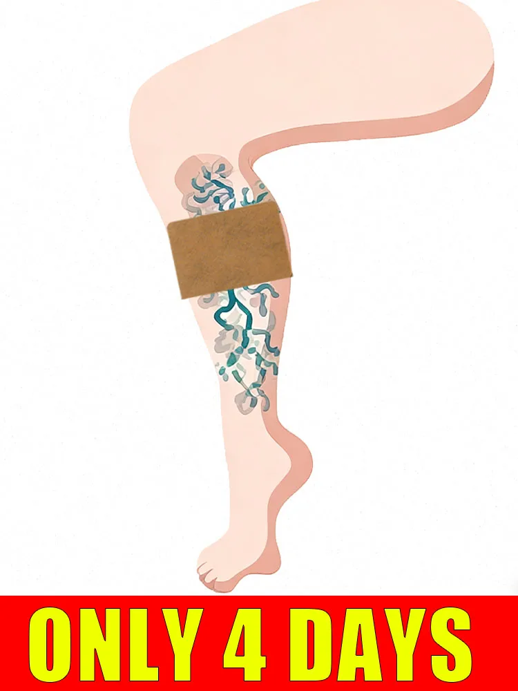 Trusted by 95% of customers worldwide.