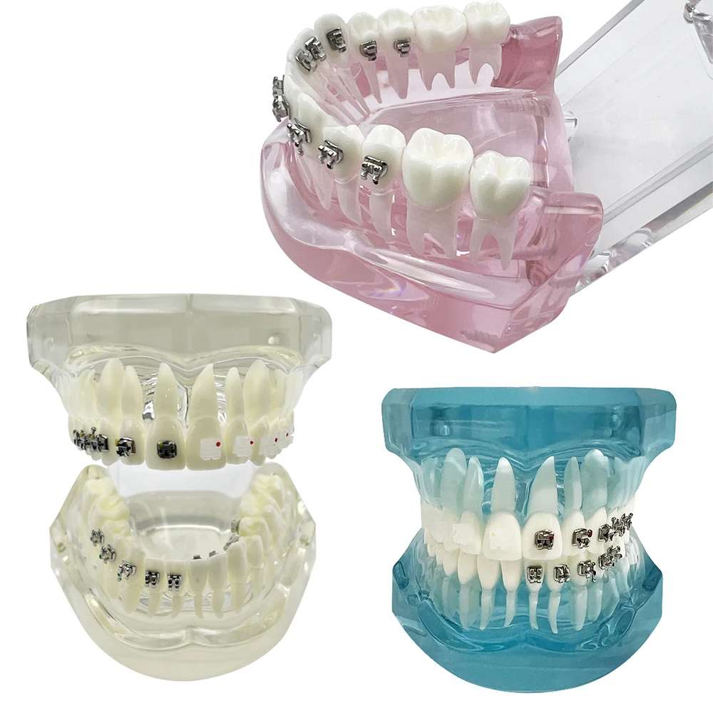 Modelo de dientes de ortodoncia Dental con soporte autoligante de Metal de cerámica, cuatro soportes linguales, modelos de comparación de odontología Teachi