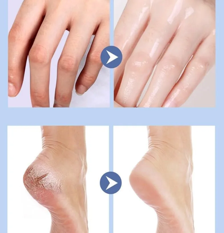Anti Cracked Foot Cream for Dry Heels, Moisturizing Foot Balm Stick, Softening Dry Skin