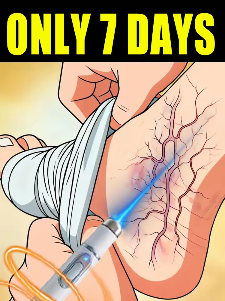 

Не волнуйтесь об варикозном расширении вен! Эффективное улучшение за 5 дней, удобное управление очень просто.