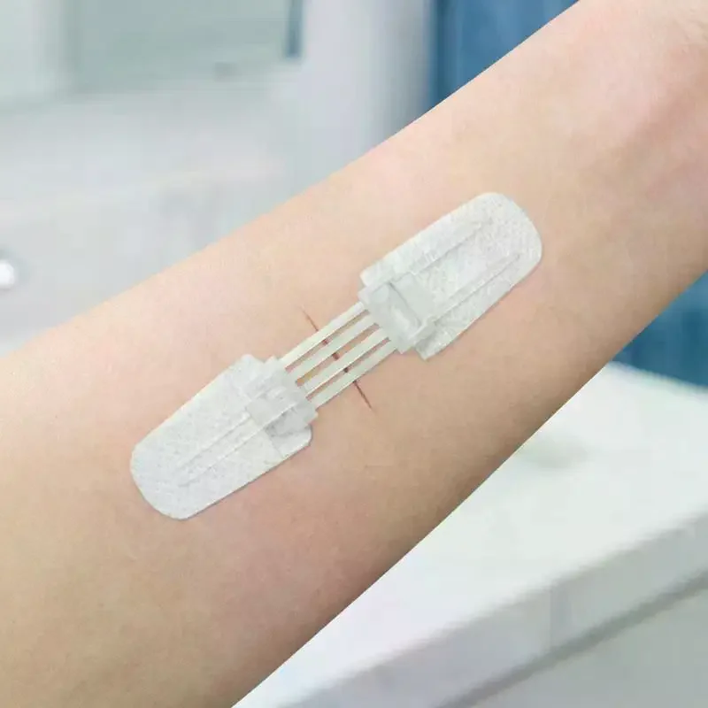 Suture-free Wound Dressing Patches Zip Zipper Band-aid Painless Wound Closure Patch Suture Reducer Band Aid Outdoor Portable