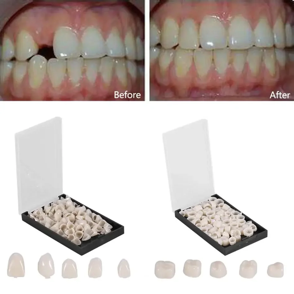 50Pcs/Box Dental Crowns Resin Porcelain Materials Temporary Teeth Crown Realistic Oral Care Teeth Whitening Anterior Molar Crown