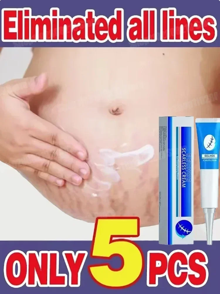 Eliminate Red White Old Stretch Marks Cream For Pregnancy Postpartum Skin Care Gel