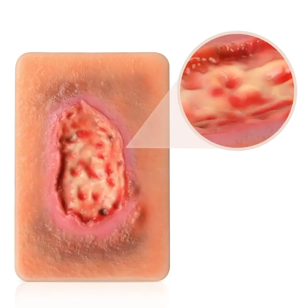 Modelset voor nekrotische weefselwondsimulatiemodellen in zakformaat