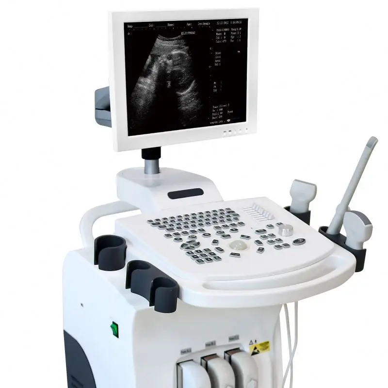 AM-370 Trolley Full Digital B/W Ultrasound very competitive price model diagnostic system