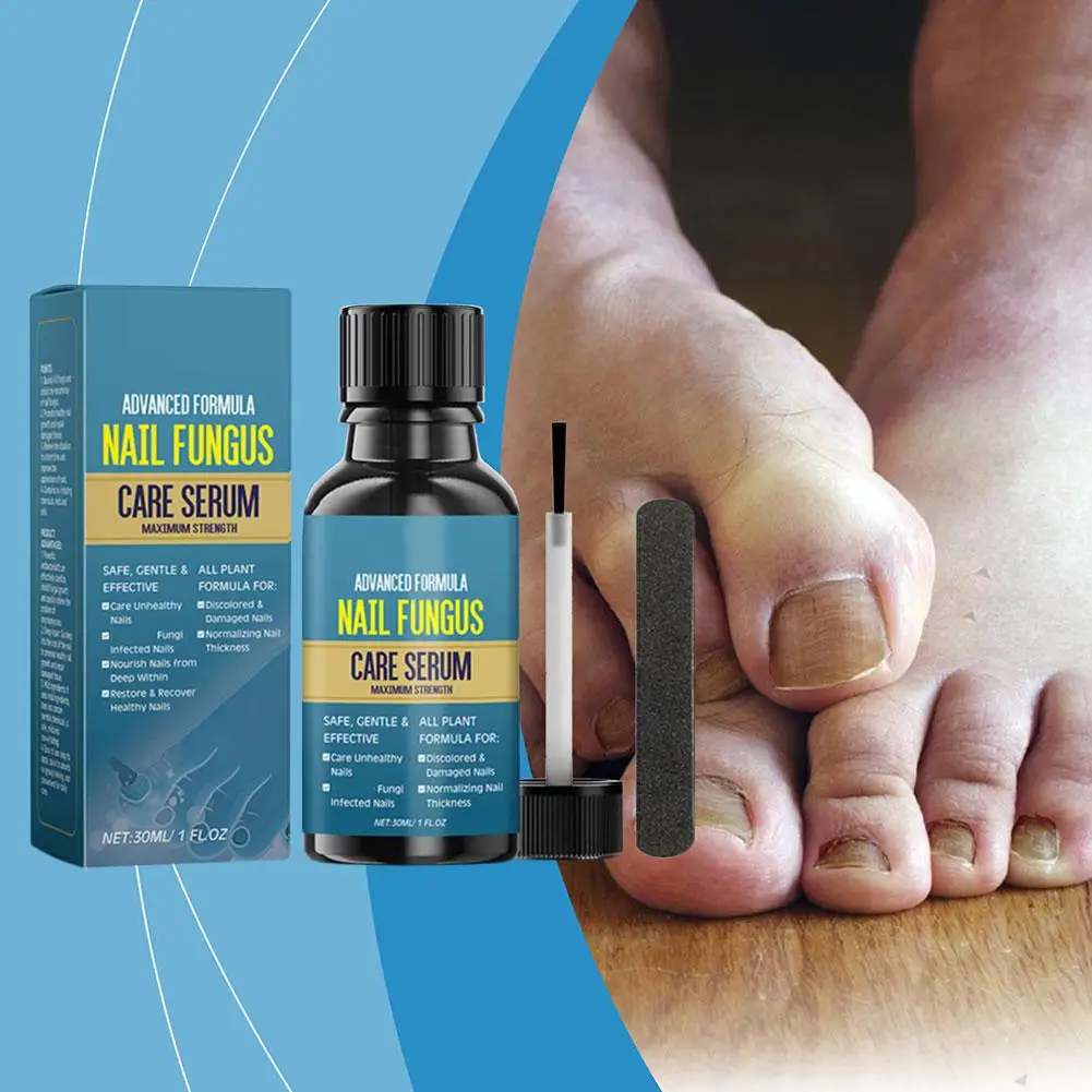 Nail Fungus Treatment Serum Foot Repair Liquid Toe Gel Nails Onychomycosis Fungal Anti Cream Removal Paronychia Infection 3 Q9F1