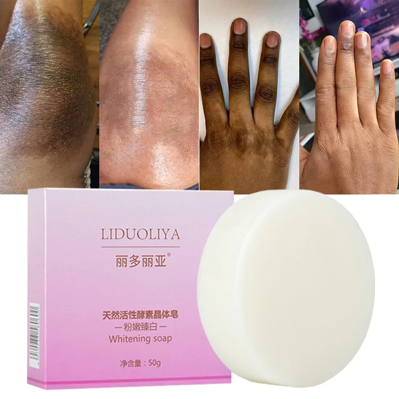 صابون تبييض الجسم تحت الإبط صابون تبييض الركبة إزالة جلد الدجاج إزالة البقع الداكنة الجلد الميت ترطيب سطع العناية بالجسم #3