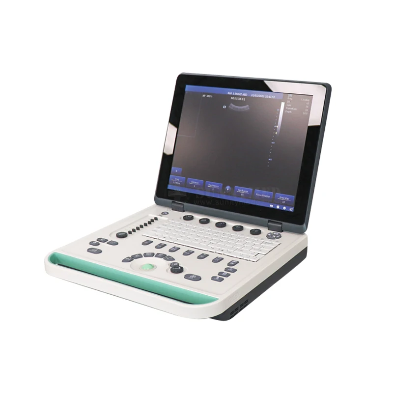 SY-A032-2 Portable Laptop Ultrasound machine ultrasonic phased array flaw detector Portable Ultrasonic Diagnostic Devices