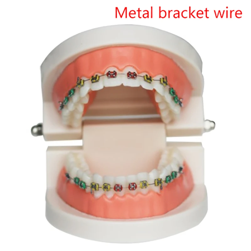 1-parowa tymczasowa dekoracja zębów z metalowymi przewodami Kolorowy metalowy wspornik i ligatury ortodontyczne Ozdoby dentystyczne