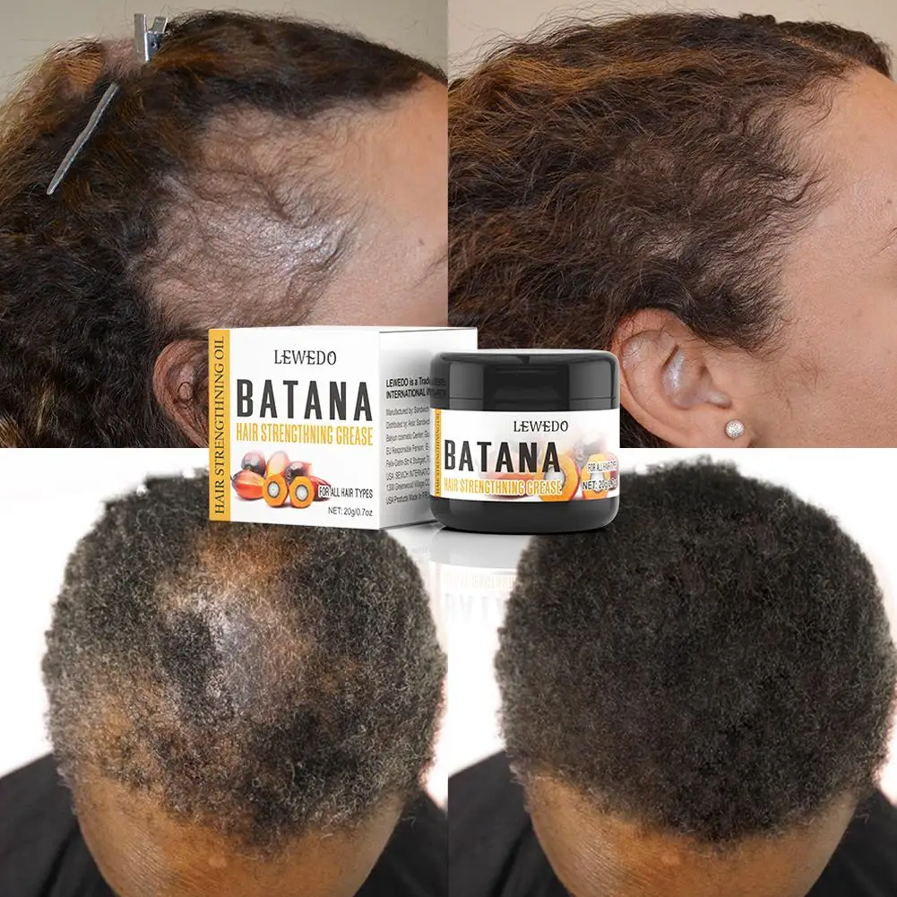 Natural Batana Oil Cream African Crazy Traction Alopecia Hair Hair Hair Cream Treatments Regrowth Break Batana Anti X9s4