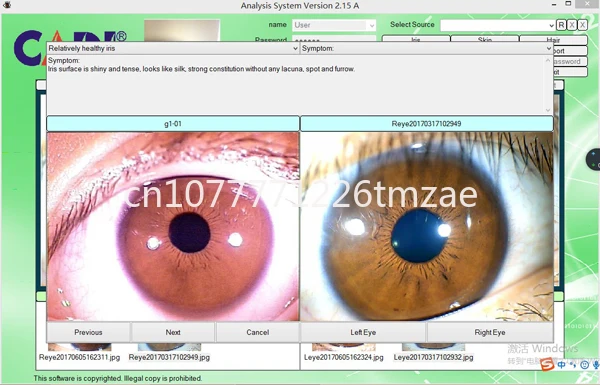 The best-selling digital iris camera with iris lenses for physical health testing