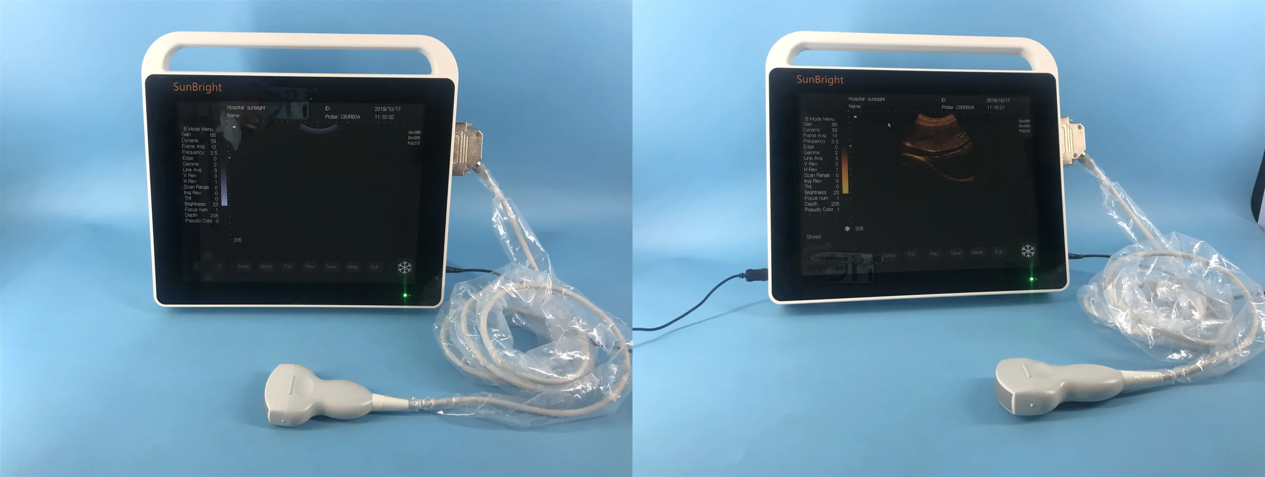 Cheap 2D Portable Echo Ultrasound Machine
