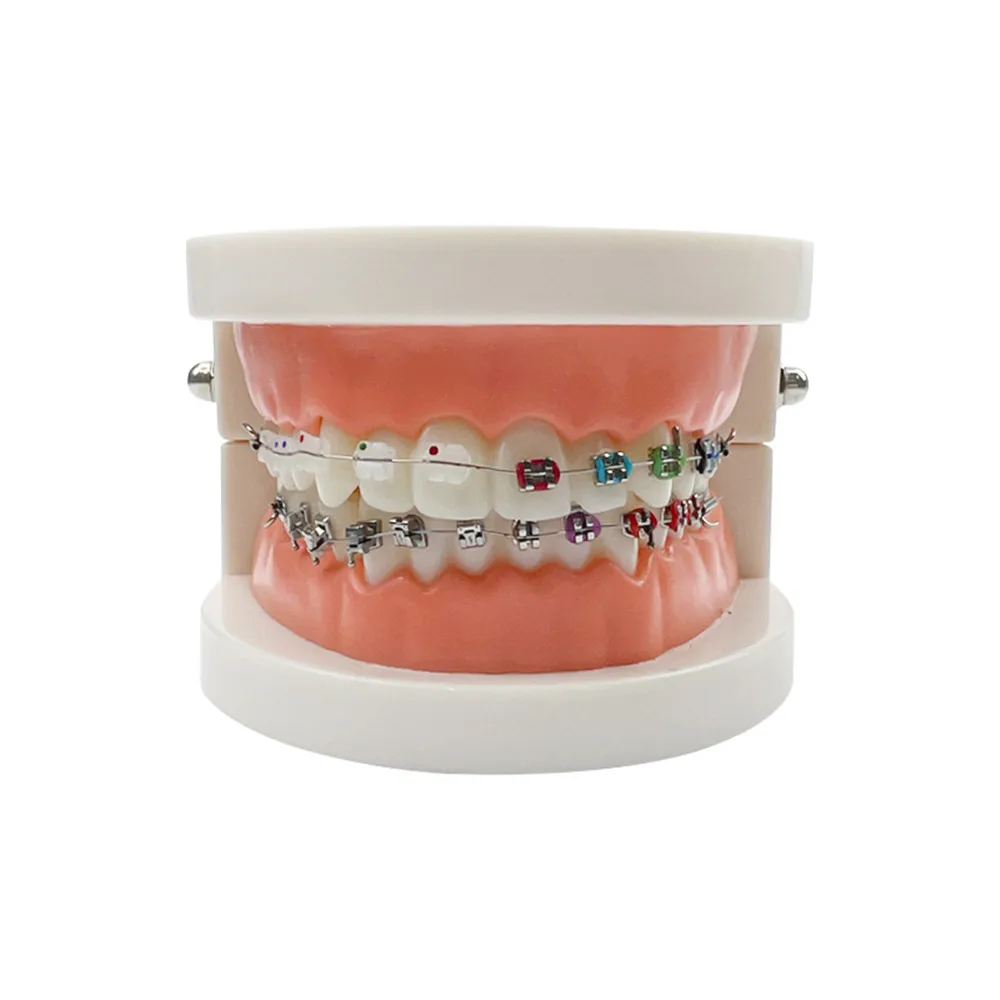 Model ortodontyczny z samodzielnym wspornikiem metalowym Aparat ceramiczny Typodont Stomatologia Zęby Nauczanie Studium Produkty demonstracyjne