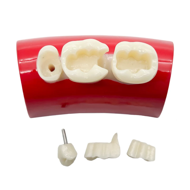 1Pcs Dental Inlay Exercise Model Block Filling Exercise Typodont Model Resin Materials Oral Filling Model Dentist Teaching Study