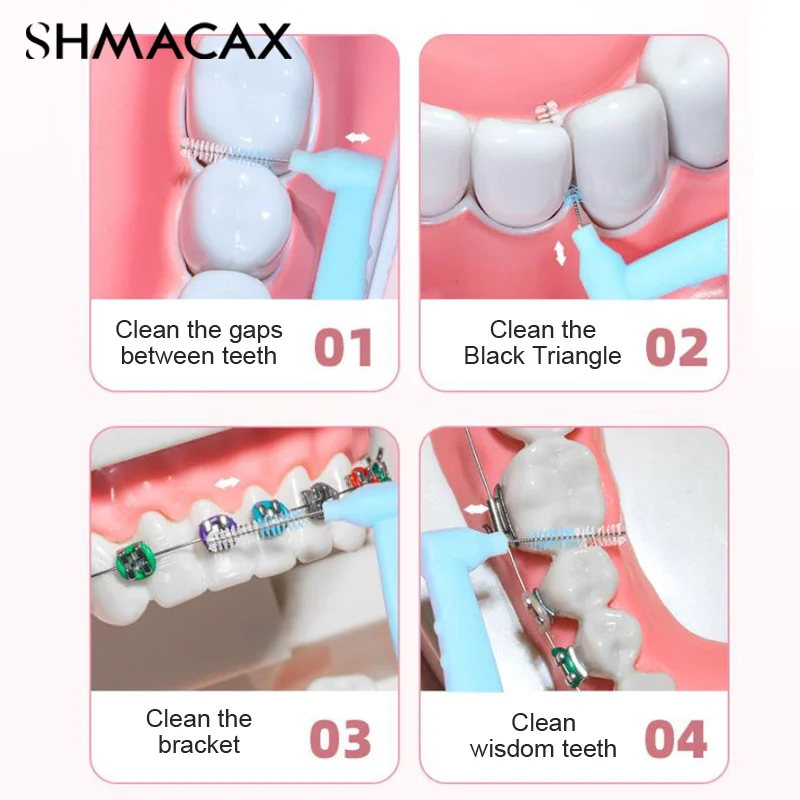 치열 교정용 치간 브러시, 치아 사이 청소, 치과 구강 위생 마이크로 브러시, 미니 브러시, 10 개