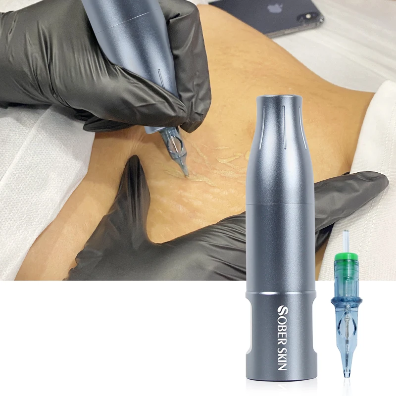 آلة تجميل دائم لاسلكية آلة التمويه لتغطية علامات التمدد إزالة إبر الوشم إصلاح الجلد بعد الولادة #2