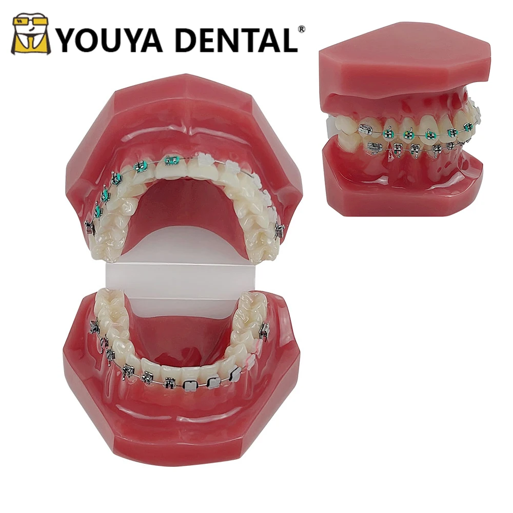 Orthodontic Model Tooth Model for Dentist Student Studying Training Practice Teaching Doctor-patient Communication Tool