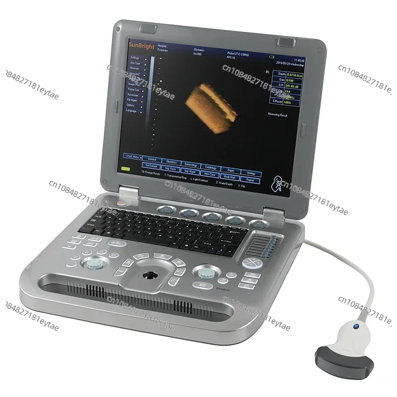 digital portable 3D ultrasound machine with echograph ultrasound system and echocardiography price