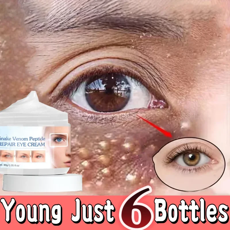 Retinol Eye Cream Get Rid Of Puffy Dark Circles Eye Bags Lifting Moisturizing Health Repairing Smoothing Eye Csdg