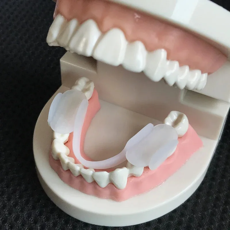 2Pcs Dental Mouth Guard Soft Teeth Splint Protector Anti-wear Silicone Tooth Pad for Grinding Clenching Teeth at Night