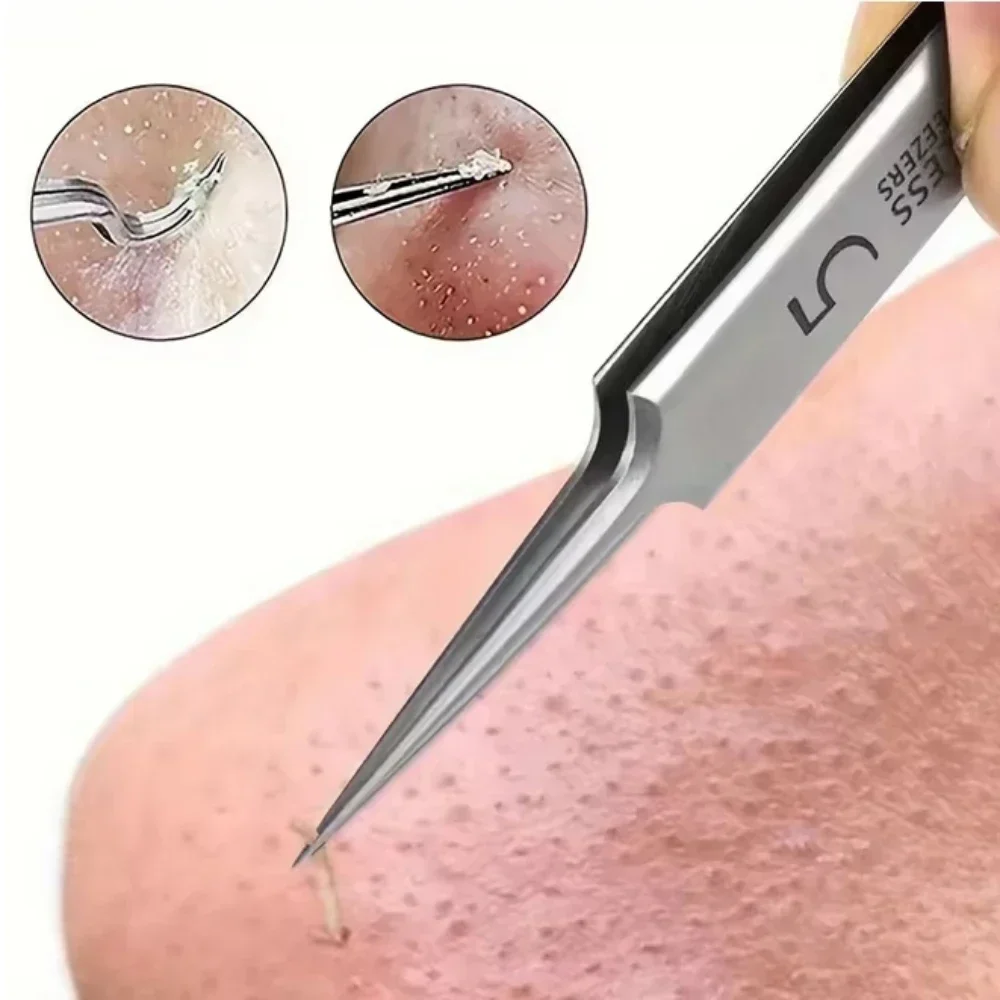 Pinzette di precisione per punti neri in acciaio inossidabile - Strumento per la rimozione dell'acne per la cura della pelle del viso Kit di bellezza professionale per estrattore di comedoni