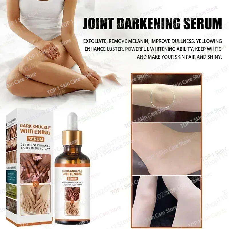 Hot sales knuckles whitening Essence For Lip Areolas Private Parts Tender Remove Intimate Melanin Skin Care Whitening Dark Spot