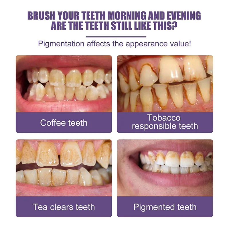 Polvere per la pulizia dei denti sbiancante fumo caffè tè smacchiatore trattamento dei denti gialli ridurre l'odore orale schiarente polvere per denti