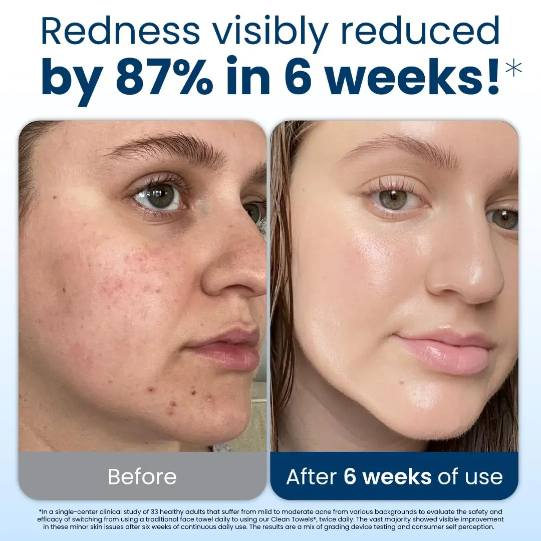 مناشف الوجه 10 بوصة × 12 بوصة منشفة وجه للاستعمال مرة واحدة مزيل مكياج فائق النعومة مناديل جافة منشفة وجه سميكة للبشرة الحساسة 50 قطعة واحدة #3