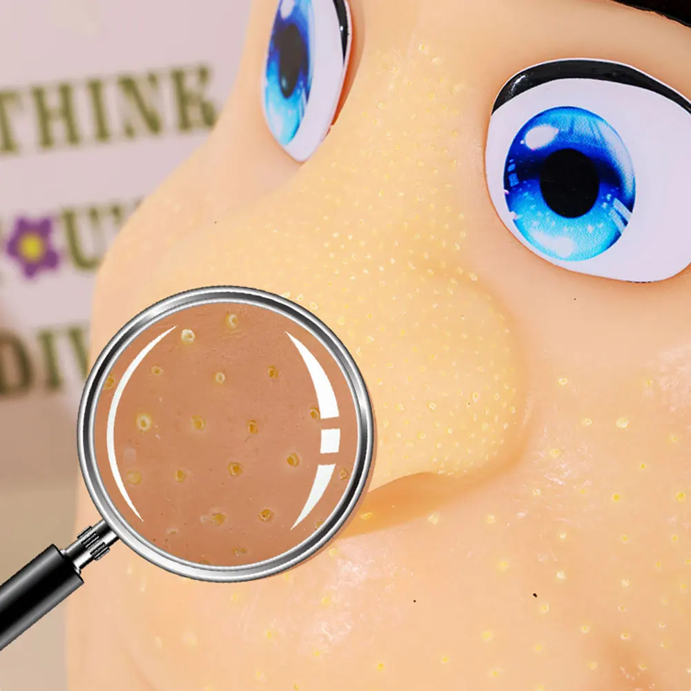 Sensory Toy For Calming ADHDs-Focus Reusable Big Head Model With Bursting Blackheads Anxiety Fidgets