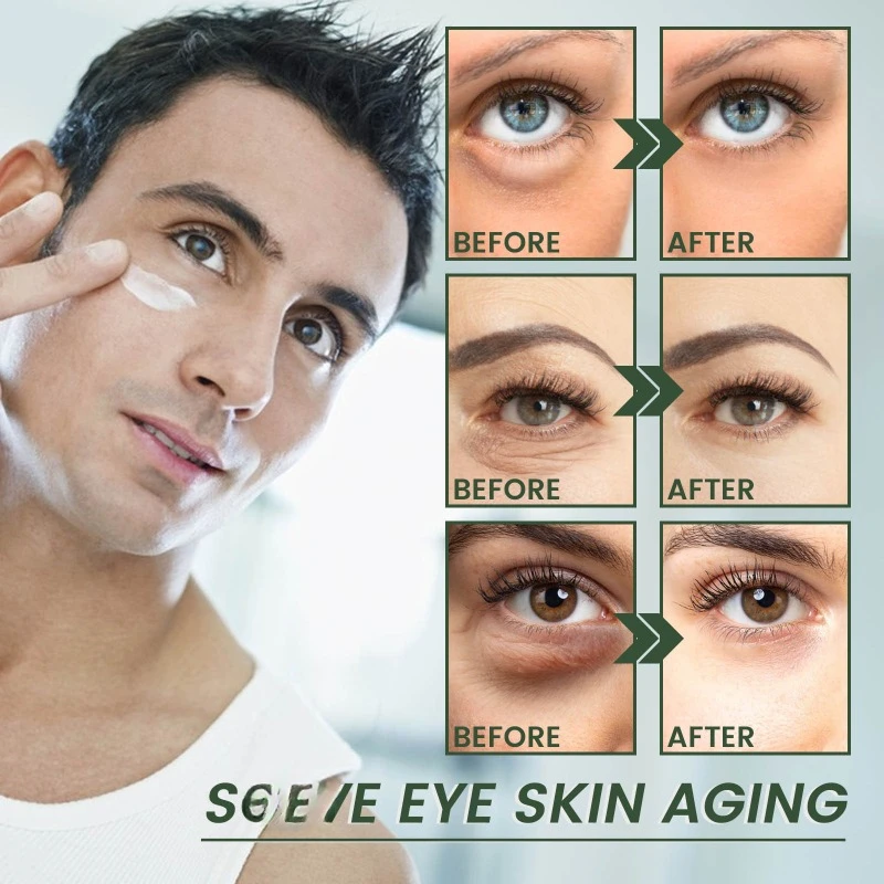 Anti aging eye cream Lifting firming wrinkle fade Dark circle remover eye bags fine lines brightening eye skin care Cream